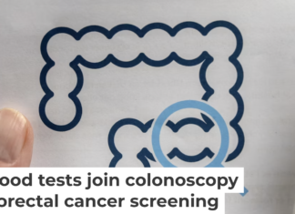 Screening is essential to prevent and effectively treat colorectal cancer. Varlay/iStock via Getty Images Plus